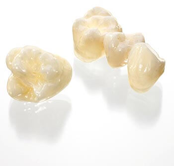 Phoenix Dental Lab ivoclar vivadent crowns 2