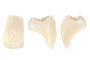 Phoenix Dental Lab ivoclar vivadent crowns