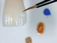 Phoenix Dental lab ivoclar vivadent external shading